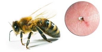 بخشی Hondrostrong عبارتند از زهر زنبور عسل که باعث بهبود فرایند های متابولیک در بافت