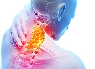 دهانه رحم osteochondrosis